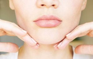 a woman received kybella chin injections