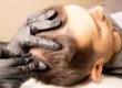 a man receives a prp hair restoration treatment at a medispa to boost his confidence and look and feel his best
