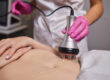 Woman undergoes procedure to feel good after debating Sculpsure vs Coolsculpting