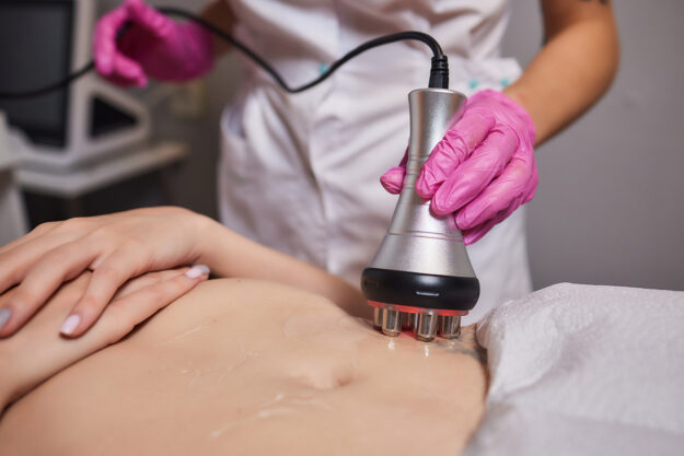 Sculpsure vs Coolsculpting Woman undergoes procedure to feel good after debating Sculpsure vs Coolsculpting